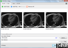 DICOM to Video(DICOM转视频工具)