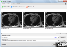 DICOM to Video(DICOM转视频工具)