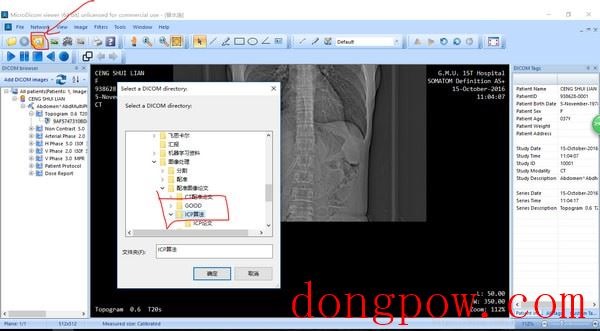 MicroDicom viewer