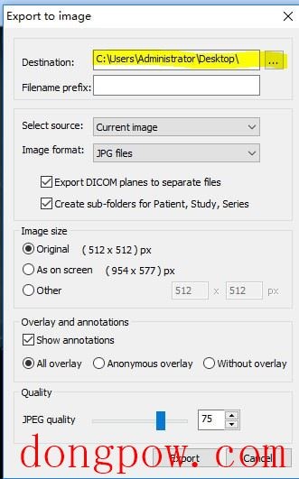 MicroDicom viewer