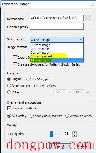 MicroDicom viewer