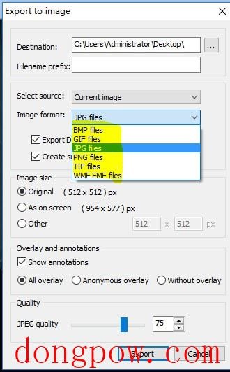 MicroDicom viewer