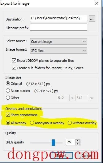 MicroDicom viewer