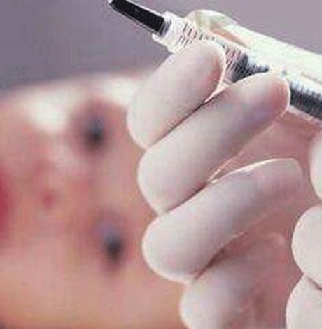 百白破疫苗是口服的吗 直接打针不能口服