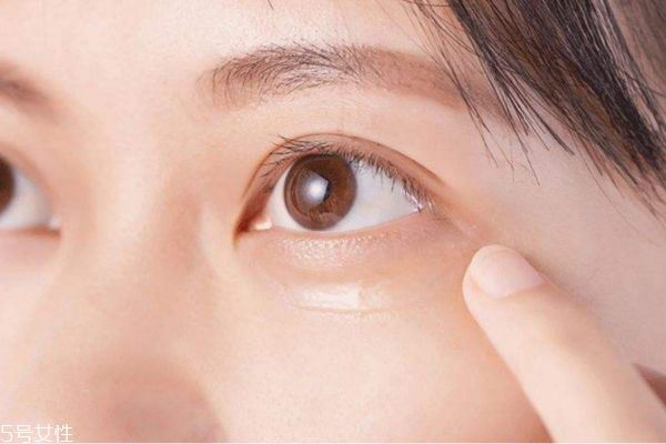眼纹是怎么形成的 眼纹产生的原因