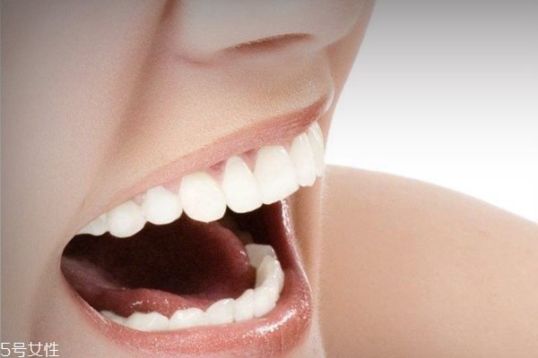 女人变老有什么特征 牙齿容易变脏也是征兆
