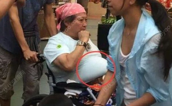 65岁洪金宝坐轮椅现身泰国，年轻时运动过量也不好吗？(2)
