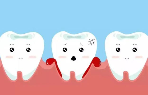 牙龈出血是什么原因？牙龈出血