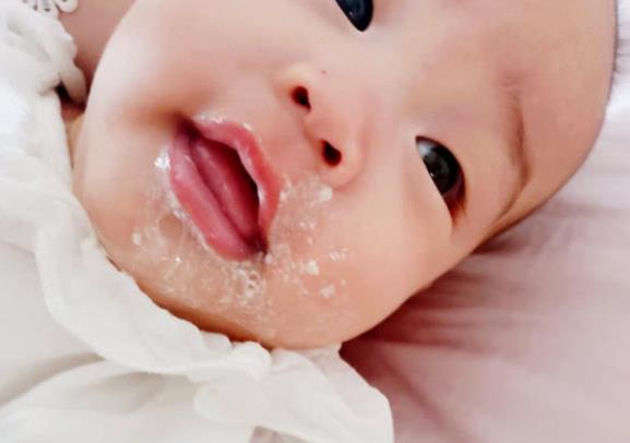 婴儿吐奶严重怎么办 按摩推拿调整喂奶姿势就医