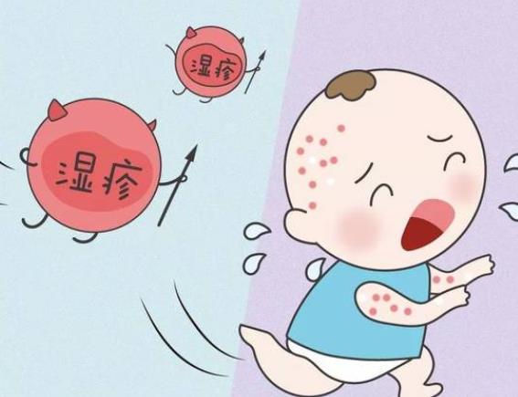 婴儿湿疹多久能好 及时干预
