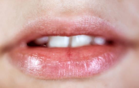 唇炎是什么原因引起的 温度