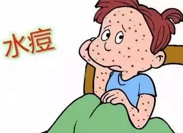 水痘初期症状图片 皮疹低热