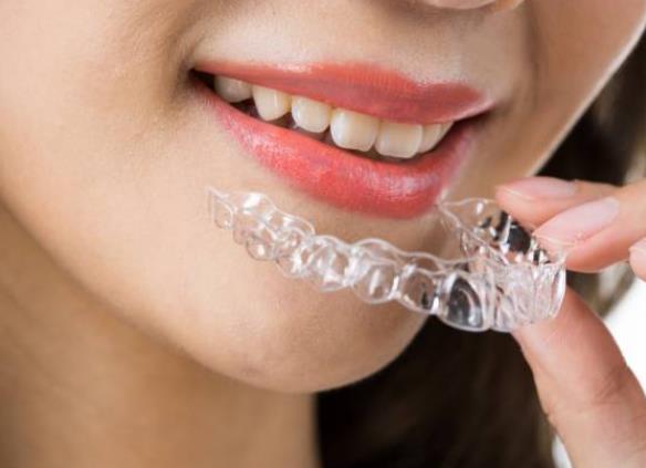 隐形牙套要戴多长时间有效 成人20—22小时/天,1—2