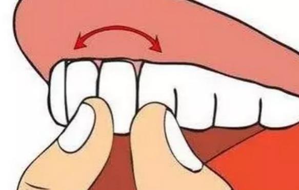 牙齿松动是什么原因 牙周炎