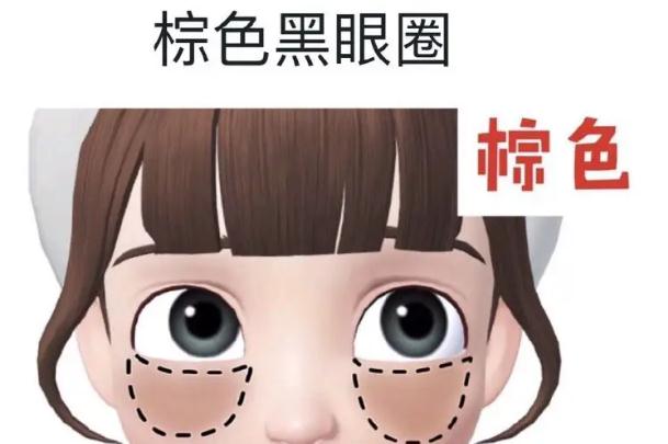 黑眼圈能做手术吗？射频去黑眼圈会反弹吗？