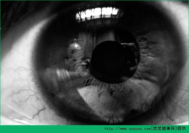 眼睛保护应从小开始 如何预防近视？(1)