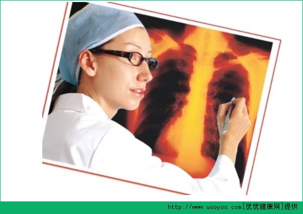 肺癌检查项目有哪些？肺癌检查挂什么科？(2)