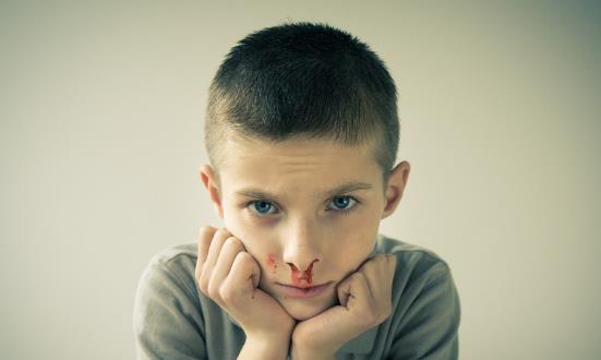 孩子流鼻血该如何处理？如何预