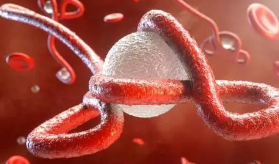 什么是艾博拉病毒？艾博拉病是