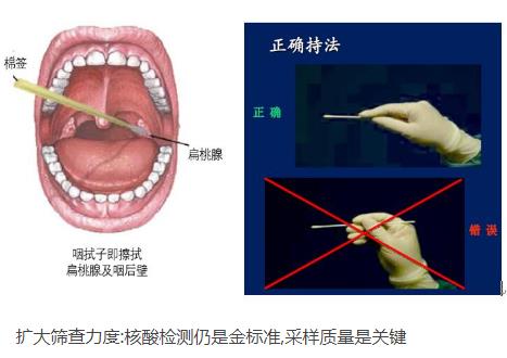 核酸检测前注意事项 如何配合医护人员做好核酸检测