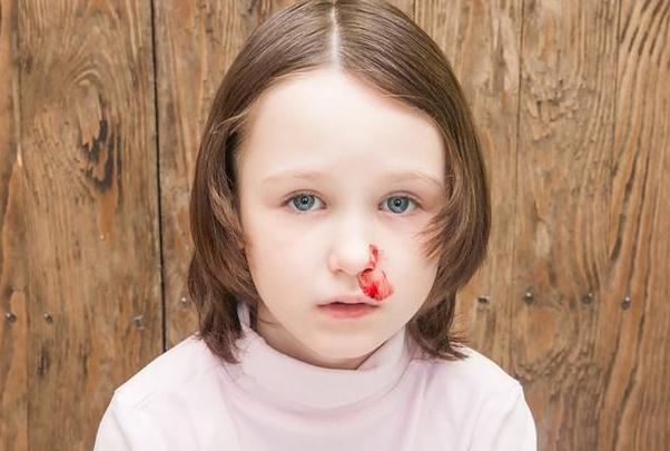 儿童为什么会流鼻血？产后坐月子流鼻血的原因是什么？