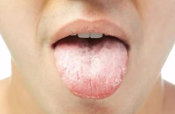 舌头发白有裂纹是什么原因 