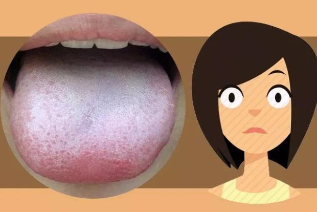 舌苔发黑是怎么回事 肠胃疾病尿毒症恶性肿瘤等