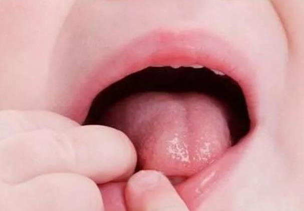 舌苔脱落是什么原因 舌炎舌