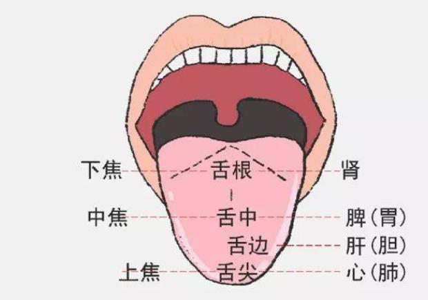 舌苔发白是什么原因 体内有水湿停留或痰饮慢性炎症