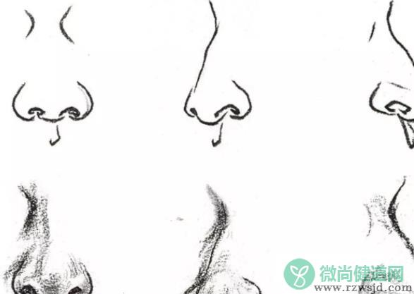 隆鼻后能运动吗 激烈运动影响手术创口恢复及效果