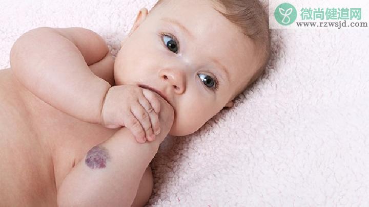 如何正确的评估婴儿血管瘤？婴
