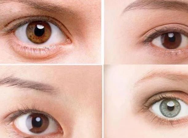 双眼皮不对称怎么调整 双眼皮术后如何护理
