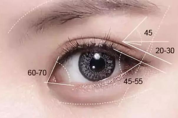 疤痕体质能割双眼皮吗 切口形成增生影响眼部美观