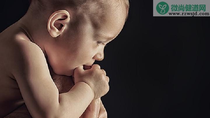 40天婴儿黄疸正常值是多少？新生儿黄疸有哪些类型？