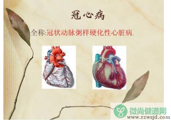 冠心病是心脏病吗？什么是肺源性心脏病？