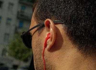耳尖放血主要适用于哪些症状_耳尖放血疗法有哪些注意事项呢