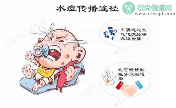 水痘怎么预防不被传染？治疗水