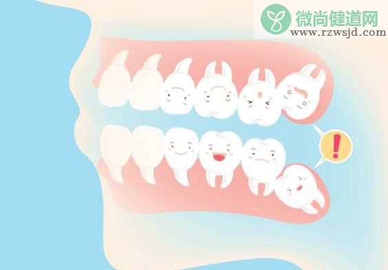 智齿是长在哪个位置 智齿处发炎是要长智齿了吗