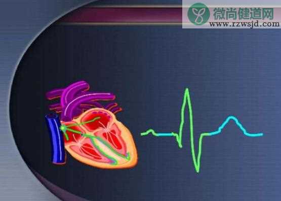 窦性心律什么意思 窦性心律