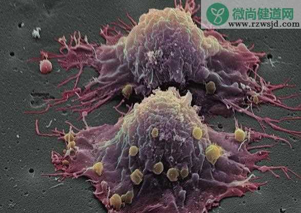 乳腺癌如何治疗 乳腺癌的病