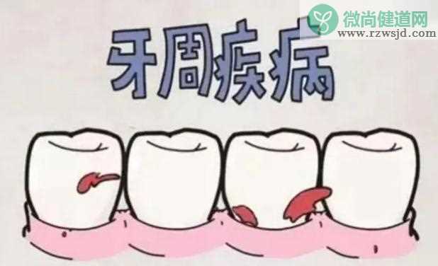 造成牙齿松动年轻化原因是什