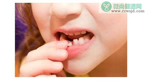 青少年牙齿松动是什么原因？牙