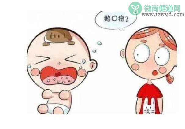 治疗宝宝鹅口疮有什么误区？如