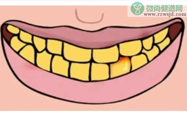 牙齿黄是缺少什么元素吗？小苏