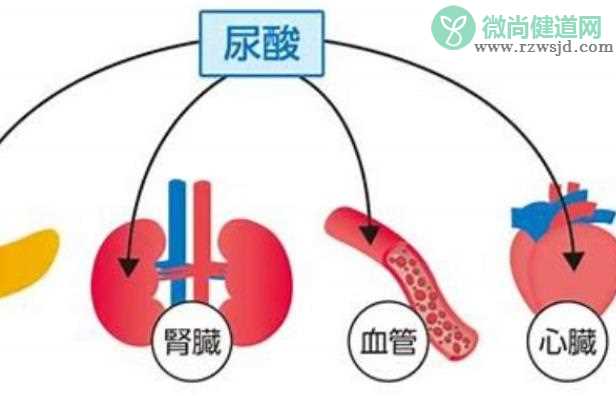 尿酸高如何降下来 控制饮食用药避免熬夜劳累