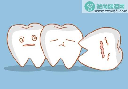 塞牙后牙疼怎么回事 塞牙缝怎么治疗