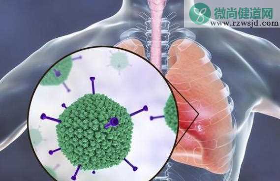 支原体肺炎和肺炎有什么区别 细菌性肺炎和支原体肺