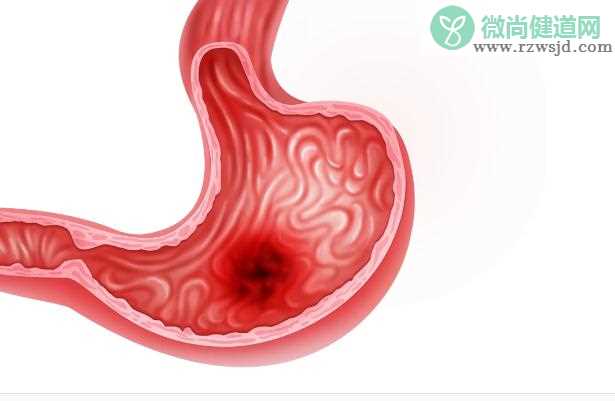 胃溃疡患者能吃火龙果吗？胃溃疡患者忌吃食物？
