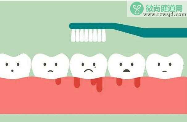 牙周炎小知识？牙周炎用什么牙刷好？