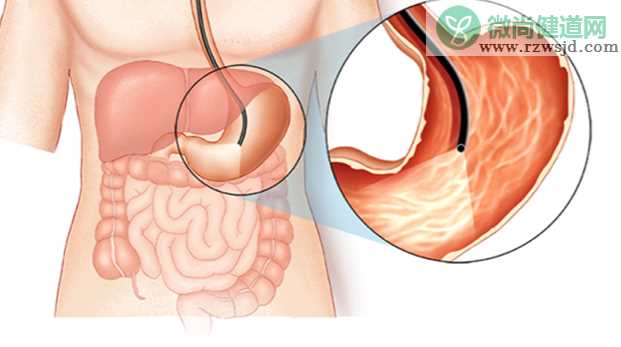 胃溃疡能吃地瓜吗 粗纤维糖刺激胃黏膜加重肠胃负担